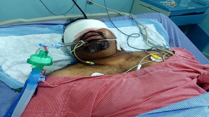 kathi Mahesh, who injured in road, health critical, shifted to Chennai kathi Mahesh, who injured in road, health critical, shifted to Chennai