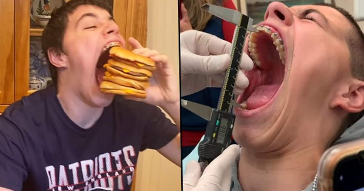 Us Teenager Sets Guinness World Record For Largest Mouth Gape Watch Video