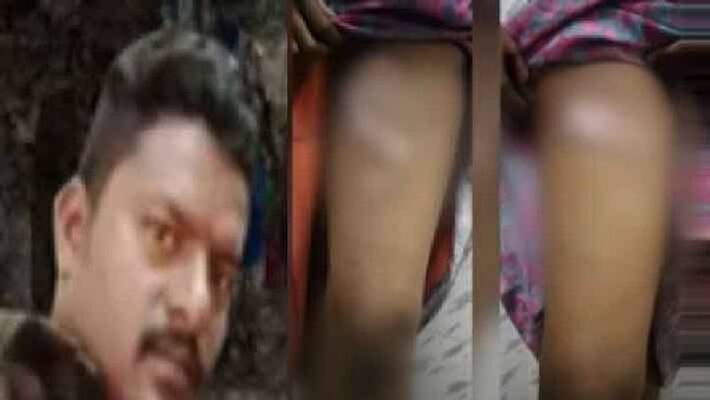 Violent husband who heated up 16 places for wife Violent husband who heated up 16 places for wife