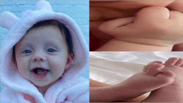 five month old baby is turning to stone due to extremely rare condition in uk ksp five month old baby is turning to stone due to extremely rare condition in uk ksp