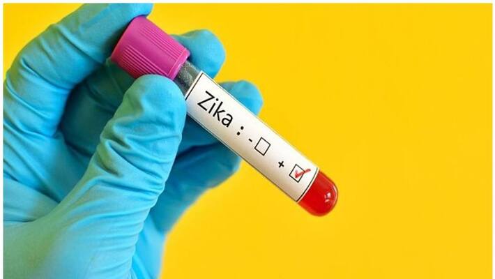 The first confirmed Zika virus patient in Karnataka is a 5-year-old girl. what is zika virus , and symptoms? The first confirmed Zika virus patient in Karnataka is a 5-year-old girl. what is zika virus , and symptoms?