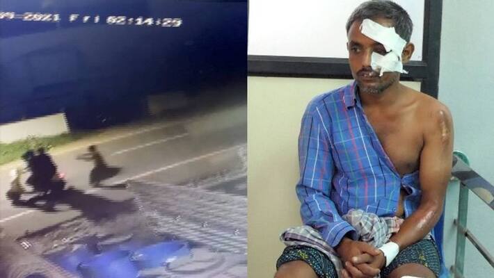 Guest worker injured in robbery attempt in Koduvalli Guest worker injured in robbery attempt in Koduvalli