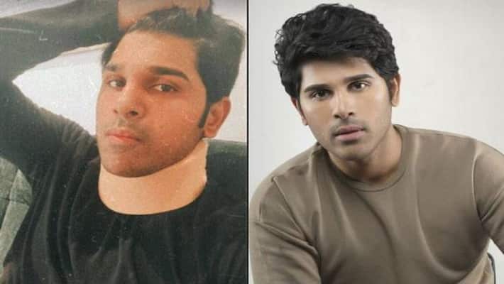 Allu Sirish neck injury jsp Allu Sirish neck injury jsp