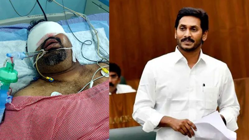 మందకృష్ణ మాదిగ డిమాండ్ మేరకు ఏపీ ప్రభుత్వం కత్తి మహేష్ మృతిపై విచారణకు ఆదేశించింది. కత్తి మహేష్ కారు డ్రైవర్ సురేష్ ని విచారణకు పిలిచినట్లు తెలుస్తుంది. కత్తి మహేష్ పై అనేక మార్లు పబ్లిక్ ప్రదేశాల్లో దాడులు జరిగిన విషయం తెలిసిందే.
