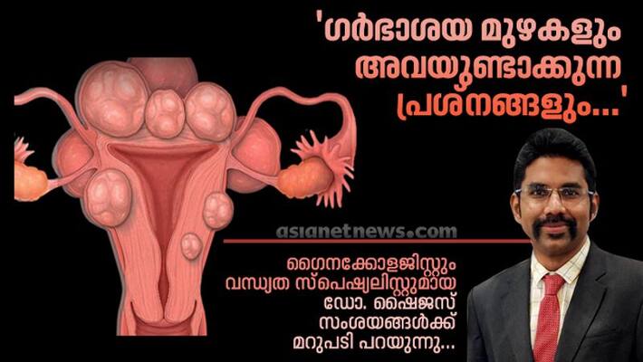 dr shyjus article about Uterine fibroids Symptoms Treatment Causes Surgery dr shyjus article about Uterine fibroids Symptoms Treatment Causes Surgery