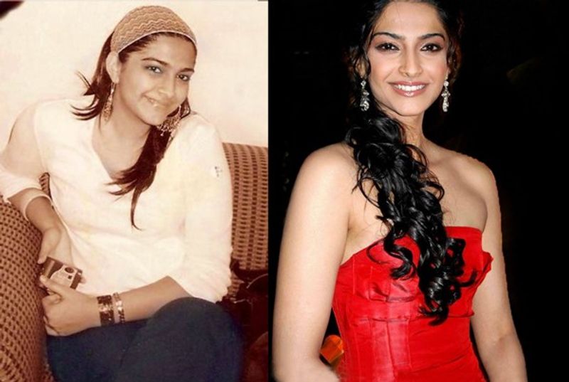 Sonam Kapoor
Sonam kapoor used to weigh 86 kgs and now she weighs around 56. The actress is sure an inspiration.