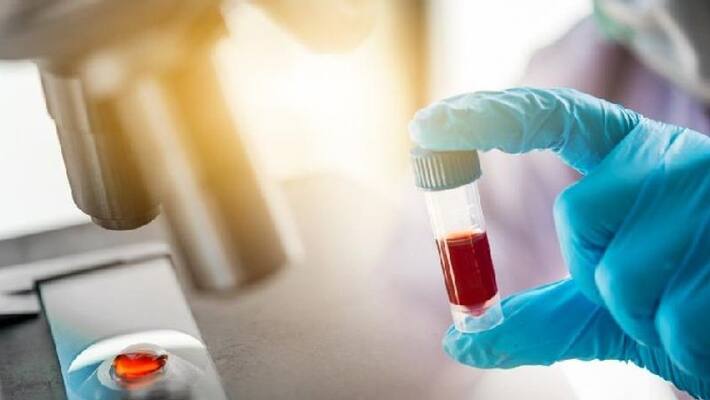 this district peoples in a first place in antibody list .. Exciting report. Look at your district! this district peoples in a first place in antibody list .. Exciting report. Look at your district!