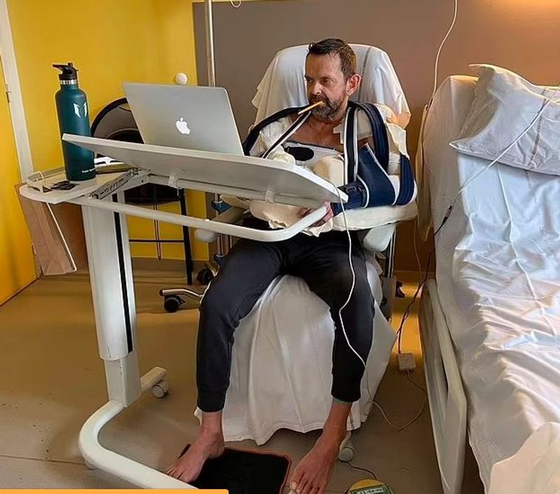 iceland world first surgery where man got his both hands transplanted kpn