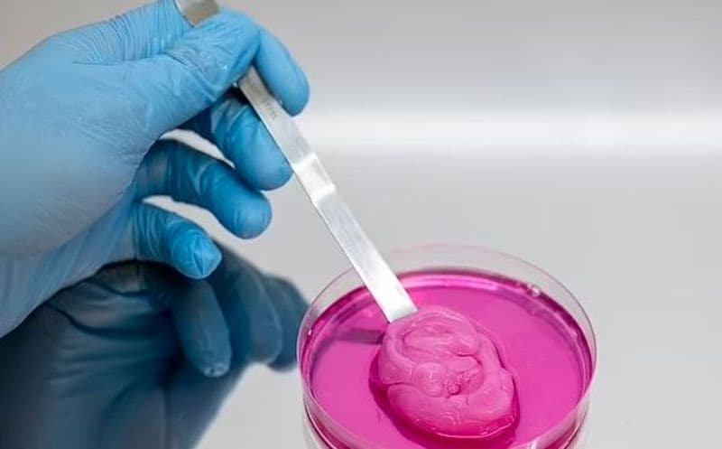 Britain new ear is been made for 10 year old girl in lab with 3D printing technology kpn