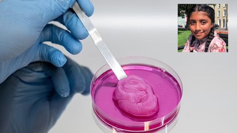 Britain new ear is been made for 10 year old girl in lab with 3D printing technology kpn