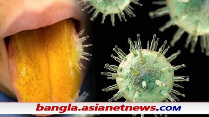 12-year-old Canada boy's tongue turns yellow, diagnosed with Epstein-Barr virus or EBV ALB 12-year-old Canada boy's tongue turns yellow, diagnosed with Epstein-Barr virus or EBV ALB