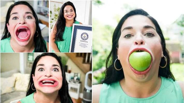 woman who can open her mouth 6.52 cm gets Guinness World Record woman who can open her mouth 6.52 cm gets Guinness World Record