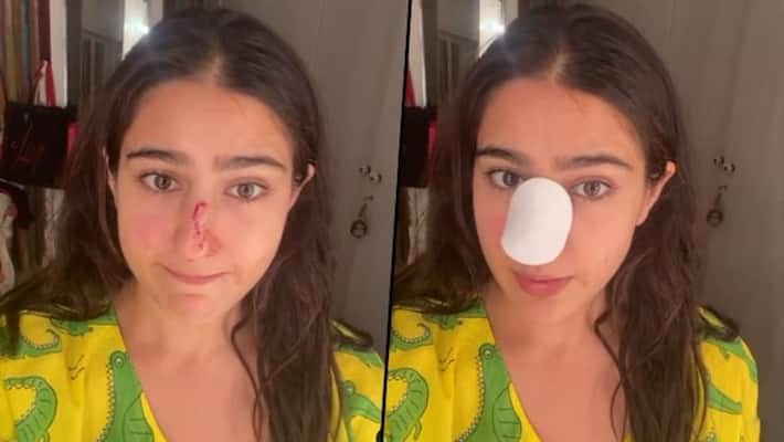 Sara Ali Khan shares funny video, shows her nose injury; watch here