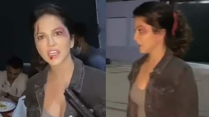 Viral Video of Sunny Leone face injuries, know the truth Viral Video of Sunny Leone face injuries, know the truth