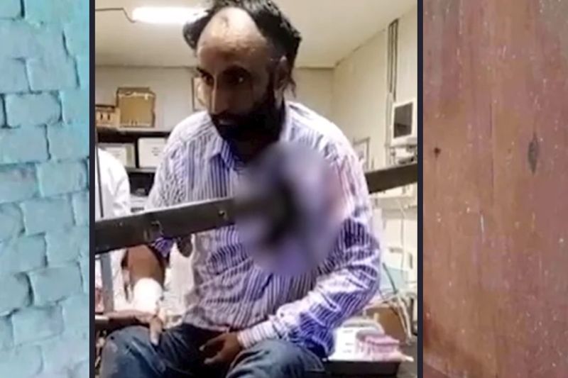 punjab news inch rod passed through the chest of a man in bathinda