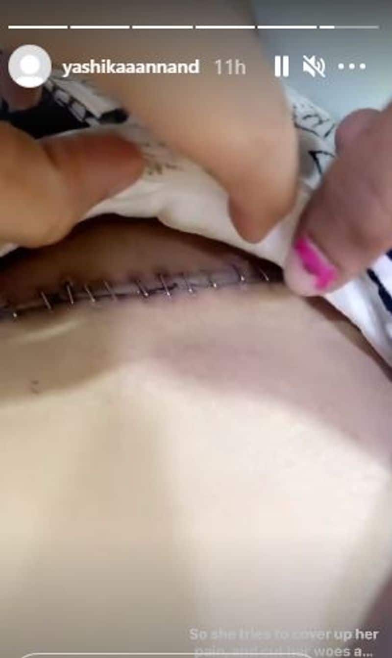 Yashika anand wound video going viral