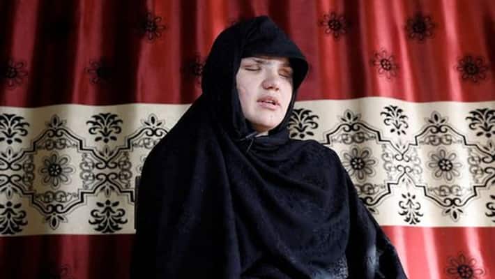 victim of Taliban violence says her eyes were gouged out victim of Taliban violence says her eyes were gouged out