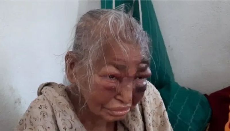 Heartbreaking pictures of post poll violence in West Bengal