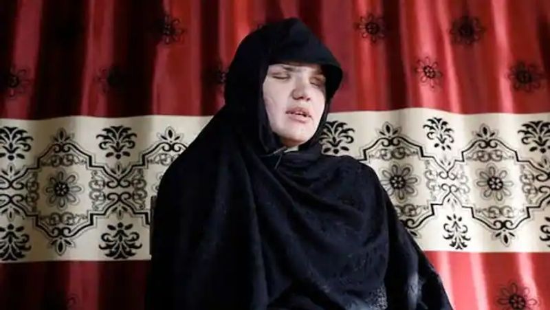 Afghan Woman reveals Taliban fighters even practice necrophilia ALB