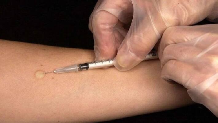 Johnson and Johnson seeks nod for Covid vaccine trial on adolescents pod Johnson and Johnson seeks nod for Covid vaccine trial on adolescents pod