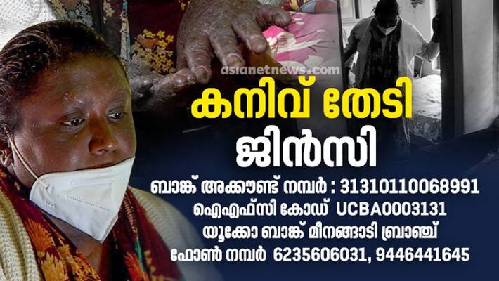 Jinsi seeks help for bone marrow transplant surgery Jinsi seeks help for bone marrow transplant surgery