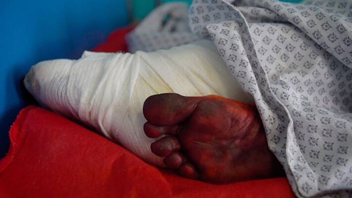 Taliban brutality women are punished by getting finger chopped for using nail varnish and wearing jeans Taliban brutality women are punished by getting finger chopped for using nail varnish and wearing jeans