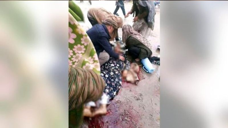 Afghan Woman reveals Taliban fighters even practice necrophilia ALB
