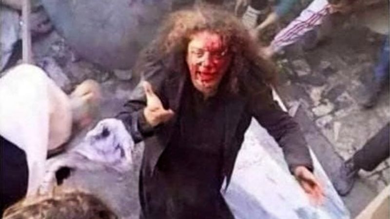 Afghan Woman reveals Taliban fighters even practice necrophilia ALB