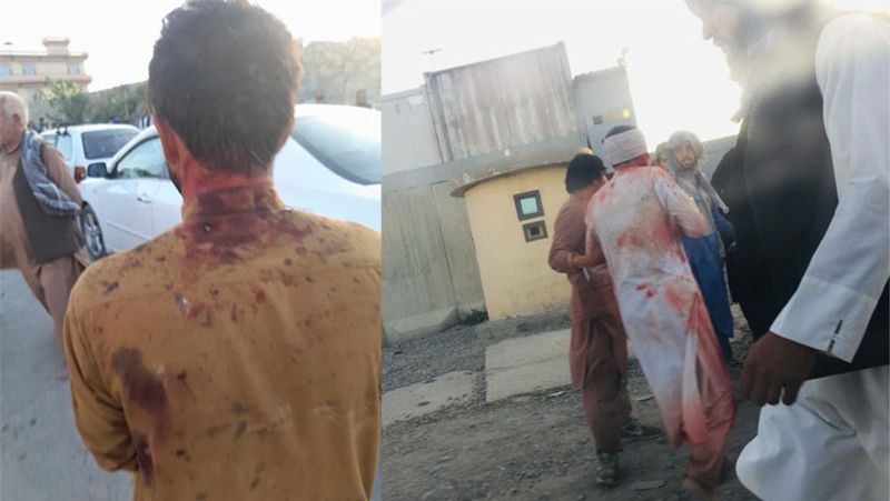 Afghanistan conflict, emotional and shocking pictures on social media about Terrorist attack on Kabul airport
