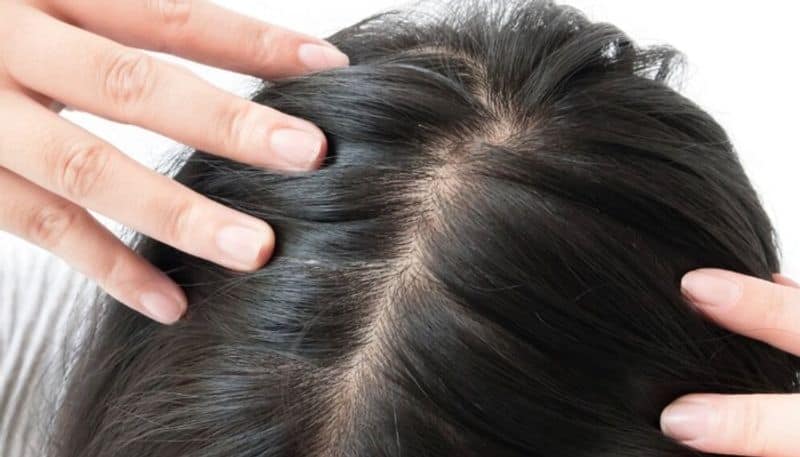 five hair care tips to treat hair thinning