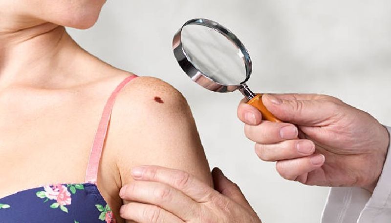 Moles On These Parts Of your Body Her is What It Means About Your Personality pod