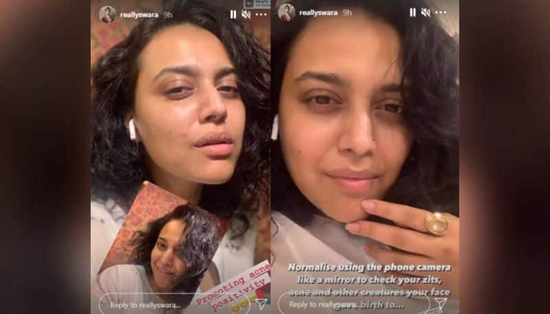 swara bhasker shared selfies for spreading acne positivity