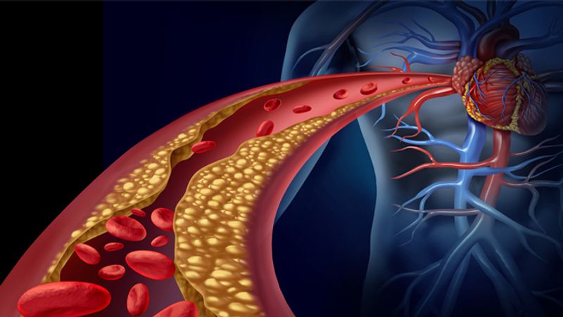 Why Heart Attacks Are Becoming Common In Younger Ages bpsb