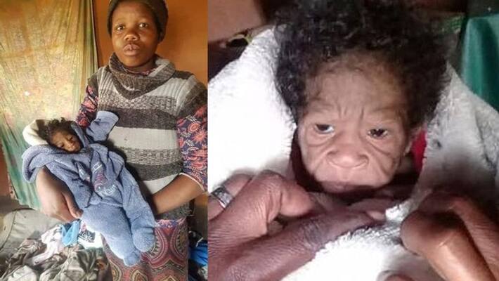 South Africa woman gave birth to a baby girl who looked like an old man South Africa woman gave birth to a baby girl who looked like an old man