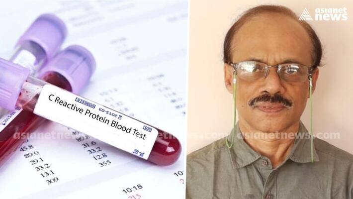 doctor n sreedhar recommends crp tests for covid patients to identify damage to health from virus doctor n sreedhar recommends crp tests for covid patients to identify damage to health from virus