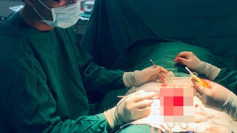 Russia drunk friend cut off another friends private part with an axe