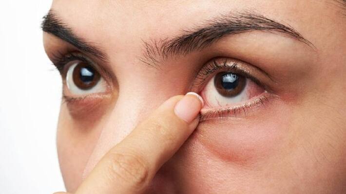 certain eye diseases may lead to dementia says a study certain eye diseases may lead to dementia says a study