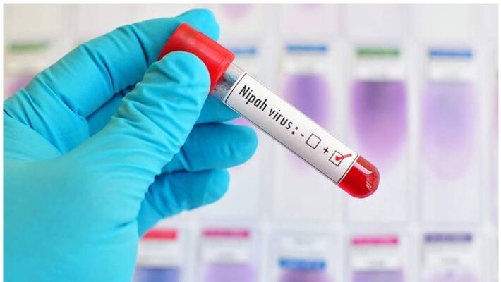 e health nipah management software ready e health nipah management software ready