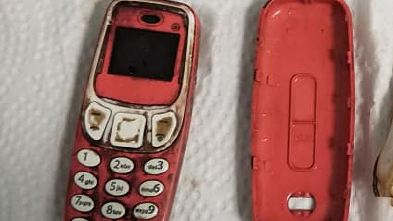 Kosovo a person swallowed a whole Nokia mobile
