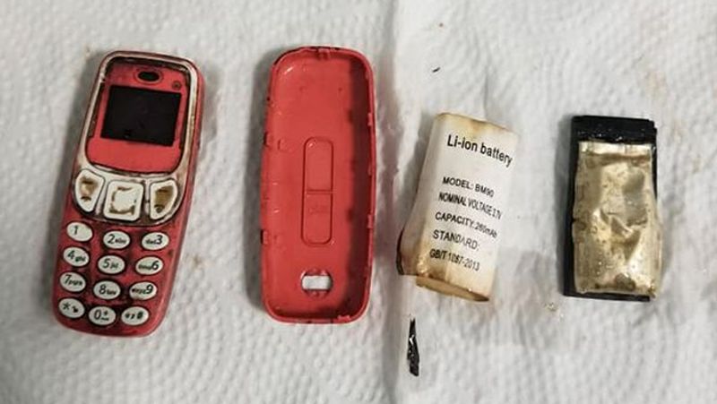 Kosovo a person swallowed a whole Nokia mobile