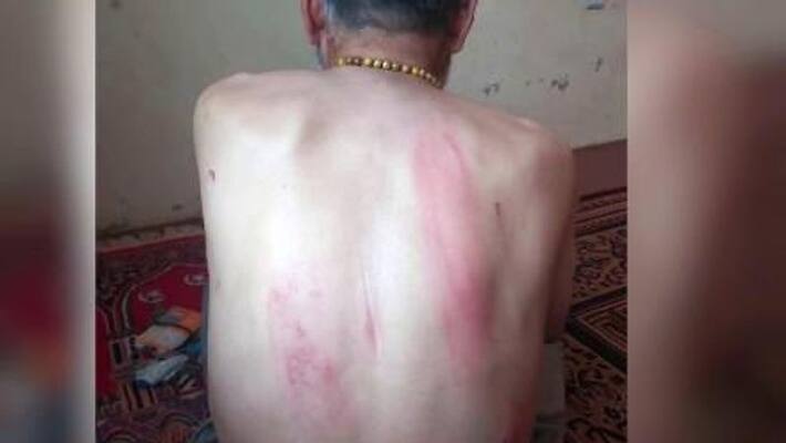 Kabul man tortured and detained by Taliban Kabul man tortured and detained by Taliban