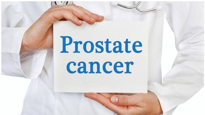 tips to prevent the Prostate Cancer tips to prevent the Prostate Cancer