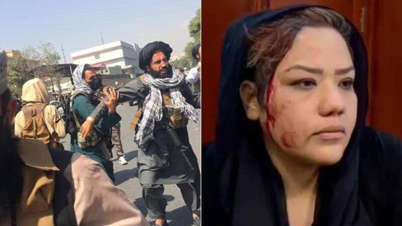 Picture showing the brutal face of the Taliban government in Afghanistan