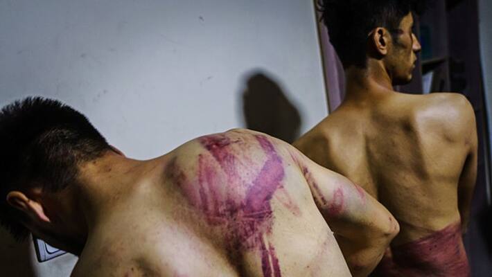 taliban beaten journalists for covering women protest in afghanistan taliban beaten journalists for covering women protest in afghanistan