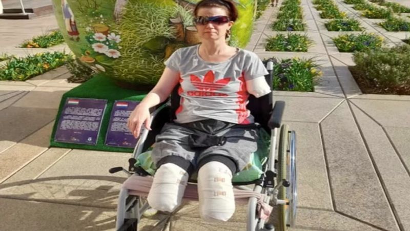 Hungary woman suffered a stomach ache but got her both feet and hands amputated