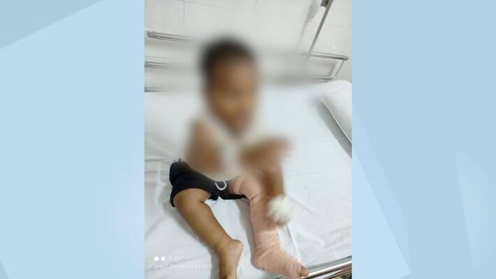 Treatment failure at primary health center One and a half year old in critical condition complains to CM Treatment failure at primary health center One and a half year old in critical condition complains to CM