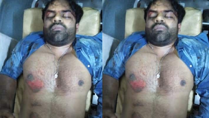 sai dharam tej injured in road accident in madhapur cable bridge sai dharam tej injured in road accident in madhapur cable bridge