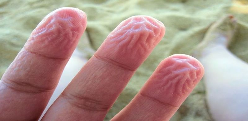 skin of fingers shriveled know why bmm
