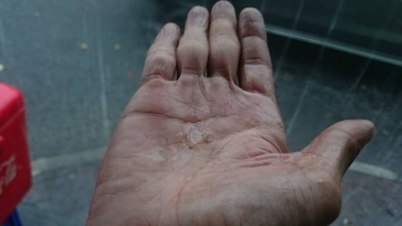 skin of fingers shriveled know why bmm