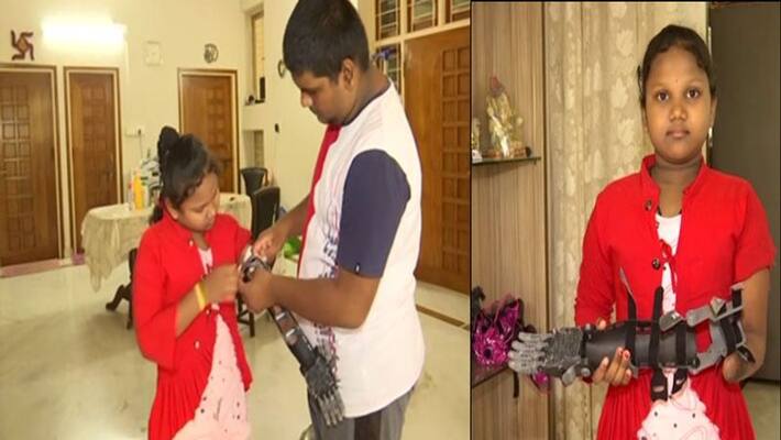 Innovative ideas, 11th student made prosthetic hand for the disabled Innovative ideas, 11th student made prosthetic hand for the disabled
